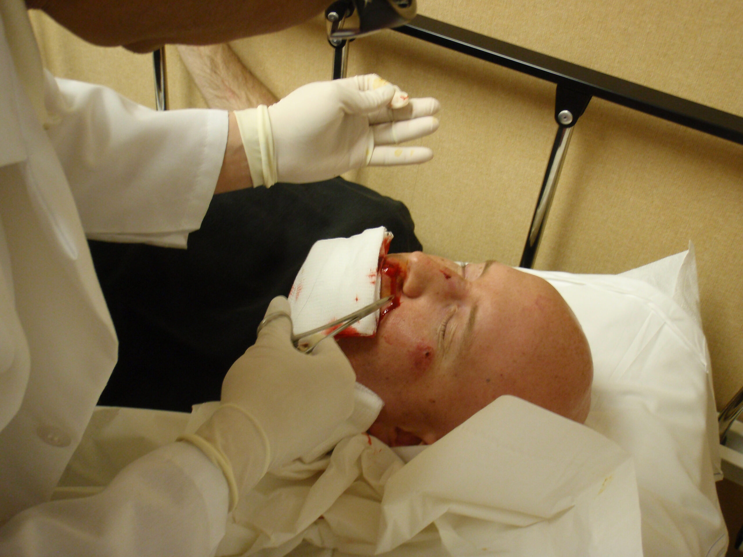 More of Dr. Maristela stitching up my face.